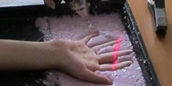 Finger entrapment